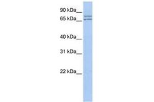 Image no. 1 for anti-DEAD (Asp-Glu-Ala-Asp) Box Polypeptide 27 (DDX27) (AA 35-84) antibody (ABIN6742687) (DDX27 Antikörper  (AA 35-84))