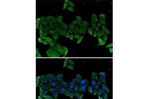 Immunofluorescence analysis of U2OS cells using COMP Polyclonal Antibody (COMP Antikörper)