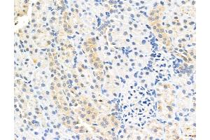ABIN6260811 and ABIN6272991 at 1/100 staining Rat kidney tissue by IHC-P. (CHMP2A Antikörper  (Internal Region))