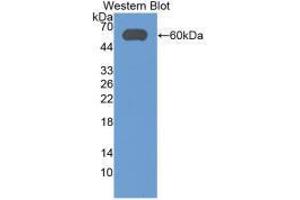 Western blot analysis of recombinant Human ALDH7A1. (ALDH7A1 Antikörper  (AA 1-539))