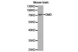 Western Blotting (WB) image for anti-Dystrophin (DMD) antibody (ABIN1872293) (Dystrophin Antikörper)