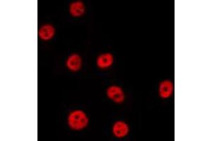 ABIN6274041 staining Hela by IF/ICC. (PTBP2 Antikörper  (Internal Region))