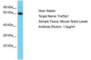 Image no. 1 for anti-TNF Receptor-Associated Factor 3 Interacting Protein 1 (TRAF3IP1) (AA 42-91) antibody (ABIN6750346) (TRAF3IP1 Antikörper  (AA 42-91))