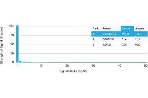 Analysis of Protein Array containing more than 19,000 full-length human proteins using Uroplakin 1B Mouse Monoclonal Antibody (UPK1B/3102) Z- and S- Score: The Z-score represents the strength of a signal that a monoclonal antibody (MAb) (in combination with a fluorescently-tagged anti-IgG secondary antibody) produces when binding to a particular protein on the HuProtTM array. (Uroplakin 1B Antikörper  (AA 109-229))