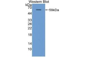 Western blot analysis of the recombinant protein. (Uromodulin Antikörper  (AA 335-590))
