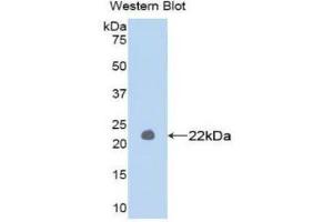 Western Blotting (WB) image for anti-Matrix Metallopeptidase 1 (Interstitial Collagenase) (MMP1) (AA 98-275) antibody (Biotin) (ABIN1172278) (MMP1 Antikörper  (AA 98-275) (Biotin))