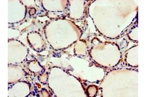 Immunohistochemistry of paraffin-embedded human thyroid tissue using ABIN7152570 at dilution of 1:100 (FUBP3 Antikörper  (AA 65-260))
