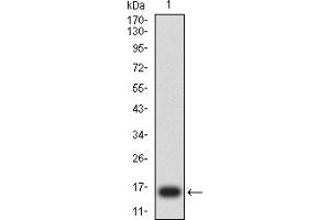 Western blot analysis using ERCC1 mAb against human ERCC1 (AA: 1-120) recombinant protein. (ERCC1 Antikörper  (AA 1-120))