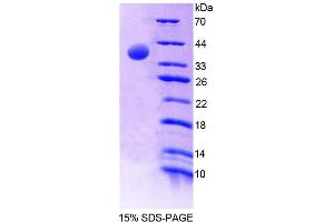 SDS-PAGE analysis of Mouse MTFMT Protein. (MTFMT Protein)