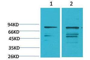 Western Blotting (WB) image for anti-Phosphoinositide 3 Kinase, p85 alpha (PI3K p85a) antibody (ABIN3181561) (PIK3R1 Antikörper)