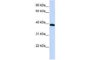 WB Suggested Anti-HOXA10 Antibody Titration:  0. (HOXA10 Antikörper  (Middle Region))