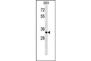 Western blot analysis of ELOVL4 Antibody (C-term) in 293 cell line lysates (35ug/lane). (ELOVL4 Antikörper  (C-Term))
