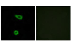 Immunofluorescence analysis of HuvEc cells, using TNAP2 antibody.