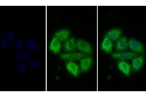 Detection of PRLR in Human MCF7 cell using Polyclonal Antibody to Prolactin Receptor (PRLR) (Prolactin Receptor Antikörper  (AA 25-234))