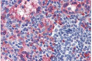 Human Spleen: Formalin-Fixed, Paraffin-Embedded (FFPE) (TXNIP Antikörper  (C-Term))