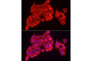 Immunofluorescence analysis of HeLa cells using INPP5K Rabbit pAb (ABIN6132112, ABIN6142473, ABIN6142474 and ABIN6223771) at dilution of 1:150 (40x lens). (INPP5K Antikörper  (AA 149-448))