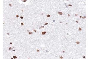 ABIN6268797 at 1/100 staining human brain tissue sections by IHC-P.