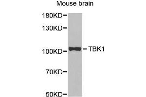 Western blot analysis of extracts of mouse brain, using TBK1 antibody. (TBK1 Antikörper)