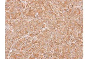 IHC-P Image Immunohistochemical analysis of paraffin-embedded SW480 xenograft, using ZNHIT1, antibody at 1:500 dilution.