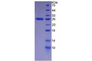 SDS-PAGE analysis of Human GSTa2 Protein.