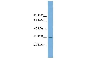WB Suggested Anti-C1orf43 Antibody Titration: 0. (C1orf43 Antikörper  (Middle Region))