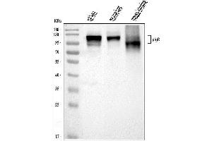 Western blot analysis of PIGR using anti-PIGR antibody (ABIN7601403).