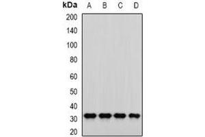 Western blot analysis of PNP expression in SKOV3 (A), MCF7 (B), mouse liver (C), mouse kidney (D) whole cell lysates. (PNP Antikörper)