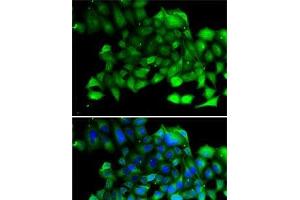 Immunofluorescence analysis of A-549 cells using CLIC4 Polyclonal Antibody (CLIC4 Antikörper)