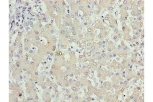 Immunohistochemistry of paraffin-embedded human liver tissue using ABIN7157483 at dilution of 1:100 (KHDC1 Antikörper  (AA 74-237))