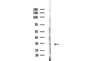 Western blot analysis of lysates from F10-LUC cells(heat-shock,45 min treatment), using MC2R Antibody at 1/1000 dilution.