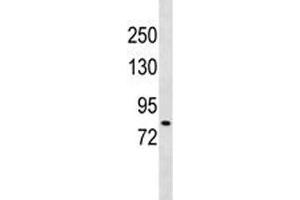 DCLK2 antibody western blot analysis in 293 lysate. (DCLK2 Antikörper  (AA 167-196))