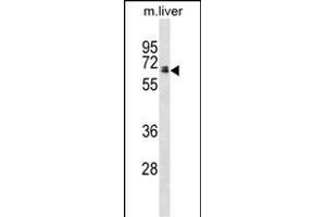 Rat Ggt1 Antibody (N-term) (ABIN1881372 and ABIN2838691) western blot analysis in mouse liver tissue lysates (35 μg/lane). (GGT1 Antikörper  (N-Term))