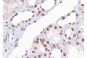 ABIN6267388 at 1/100 staining human Kidney tissue sections by IHC-P. (ATF2 Antikörper  (pSer94, pSer112))