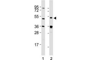 Western blot testing of LAG3 antibody at 1:2000 dilution tested on lysates from Lane 1: 293T; 2: human spleen; Predicted molecular weight ~54 kDa. (LAG3 Antikörper  (AA 103-132))