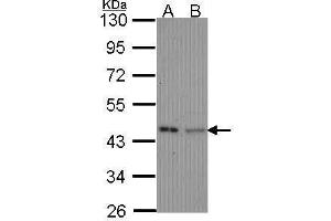 Western Blotting (WB) image for anti-Isovaleryl-CoA Dehydrogenase (IVD) antibody (ABIN2856960)