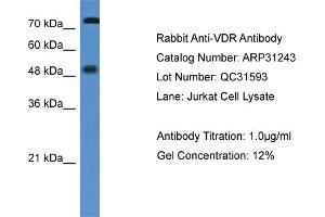 WB Suggested Anti-VDR Antibody   Titration: 1.
