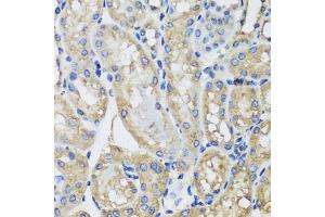 Immunohistochemistry of paraffin-embedded mouse kidney using MRPS22 antibody. (MRPS22 Antikörper)