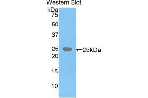 Western blot analysis of the recombinant protein. (FDFT1 Antikörper  (AA 217-416))