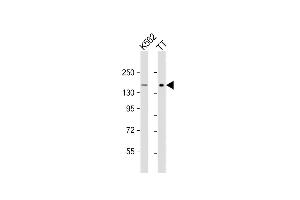 All lanes : Anti-c-KIT Antibody (C-term) at 1:1000 dilution Lane 1: K562 whole cell lysate Lane 2: TT whole cell lysate Lysates/proteins at 20 μg per lane. (KIT Antikörper  (AA 912-941))