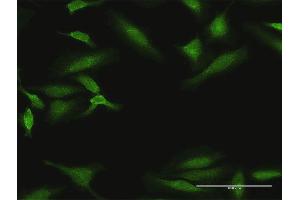 Immunofluorescence of purified MaxPab antibody to DYRK1B on HeLa cell. (DYRK1B Antikörper  (AA 1-629))