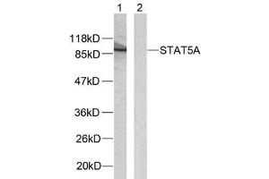 Western blot analysis of extracts from HeLa cells using STAT5A (Ab-780) antibody (E021049). (STAT5A Antikörper)