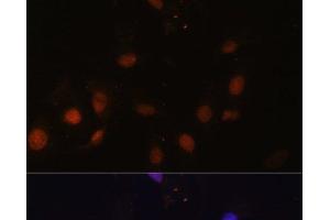 Immunofluorescence analysis of U-2 OS cells using SNW1 Polyclonal Antibody at dilution of 1:100. (SNW1 Antikörper)