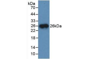 Detection of Recombinant CTSB, Mouse using Polyclonal Antibody to Cathepsin B (CTSB) (Cathepsin B Antikörper  (AA 129-333))