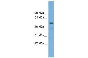 WB Suggested Anti-TRIM38 Antibody Titration: 0. (TRIM38 Antikörper  (Middle Region))