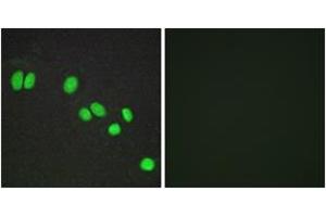 Immunofluorescence analysis of A549 cells, using NCOR2 Antibody.