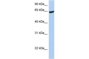 Western Blotting (WB) image for anti-Insulin-Like Growth Factor 2 mRNA Binding Protein 1 (IGF2BP1) antibody (ABIN2462219)