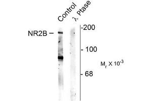Image no. 1 for anti-Glutamate Receptor, Ionotropic, N-Methyl D-Aspartate 2B (GRIN2B) (pSer1480) antibody (ABIN372688)