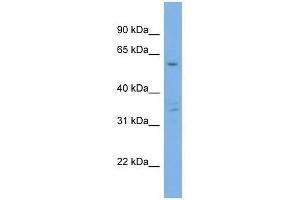 Ubiquilin 4 antibody used at 1 ug/ml to detect target protein.