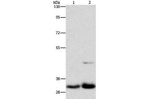 Western Blot analysis of Lovo and PC3 cell using MPG Polyclonal Antibody at dilution of 1:950 (MPG Antikörper)