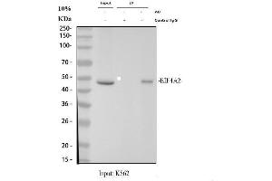 Immunoprecipitating (IP) eIF4A2 in K562 whole cell lysate.